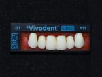 SR Vivodent S DCL / SR Orthotyp S DCL - Görsel 9