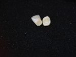 SR Vivodent S DCL / SR Orthotyp S DCL - Görsel 18
