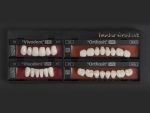 SR Vivodent S PE / SR Orthosit S PE - Görsel 5