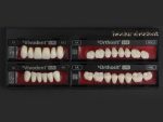 SR Vivodent S PE / SR Orthosit S PE - Görsel 6