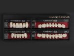 SR Vivodent S PE / SR Orthosit S PE - Görsel 7